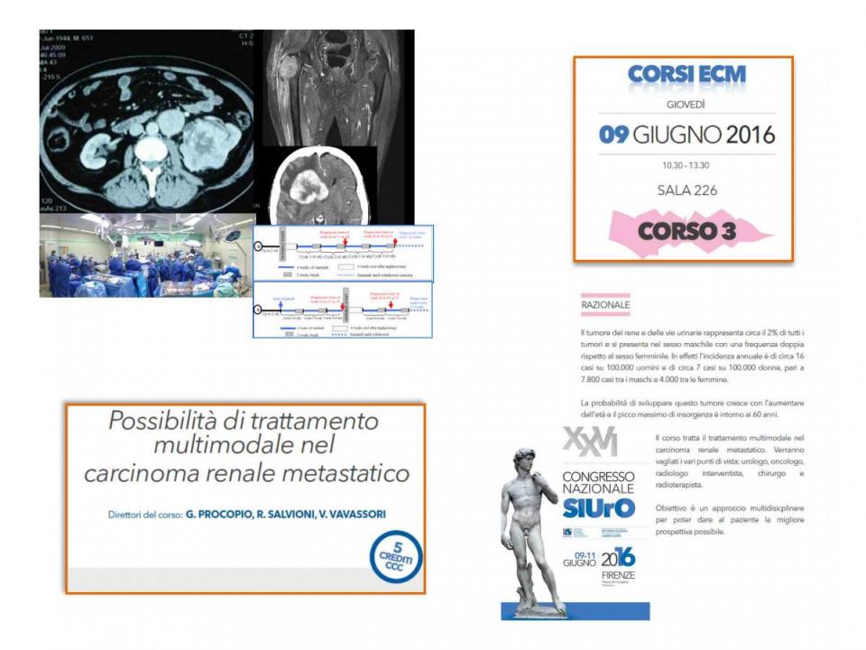 Corso ECM 3 - Possibilità di trattamento multimodale nel carcinoma renale metastatico